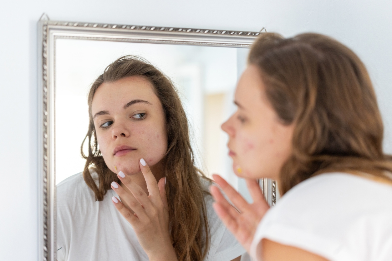 Kulit Jadi Lebih Sensitif Sebelum Menstruasi? Ini Penyebab dan Cara Mengatasinya!