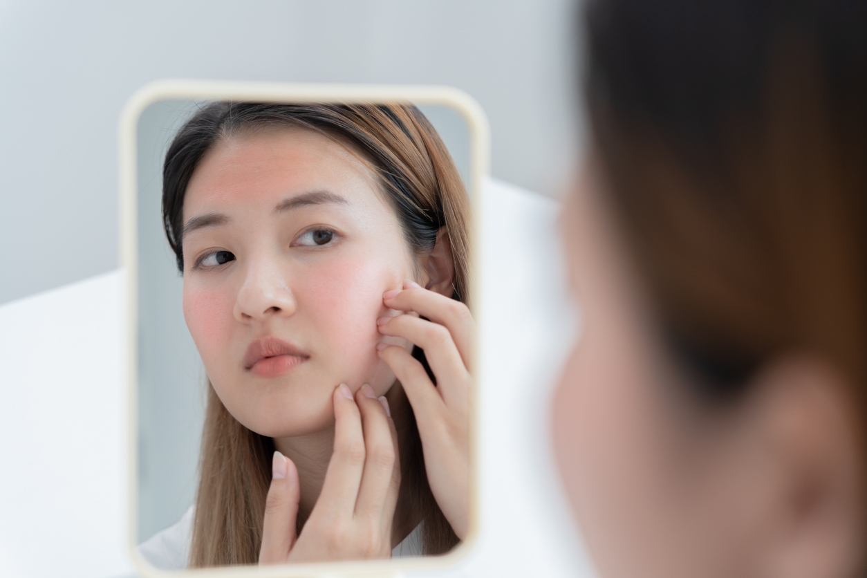 Kulit Kering Nggak Kunjung Membaik? Coba Teknik Skin Flooding untuk Mengatasinya!