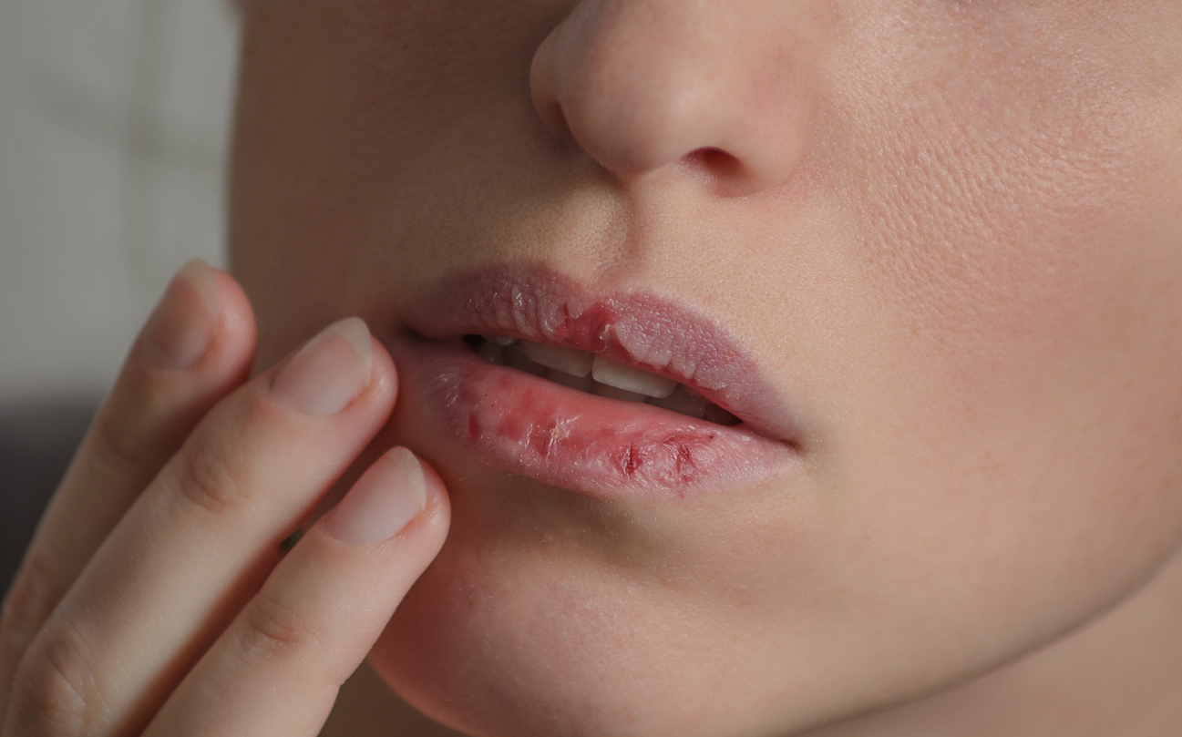 Lip Tint Bikin Bibir Kering? Mungkin Kamu Masih Melakukan 5 Kesalahan Ini
