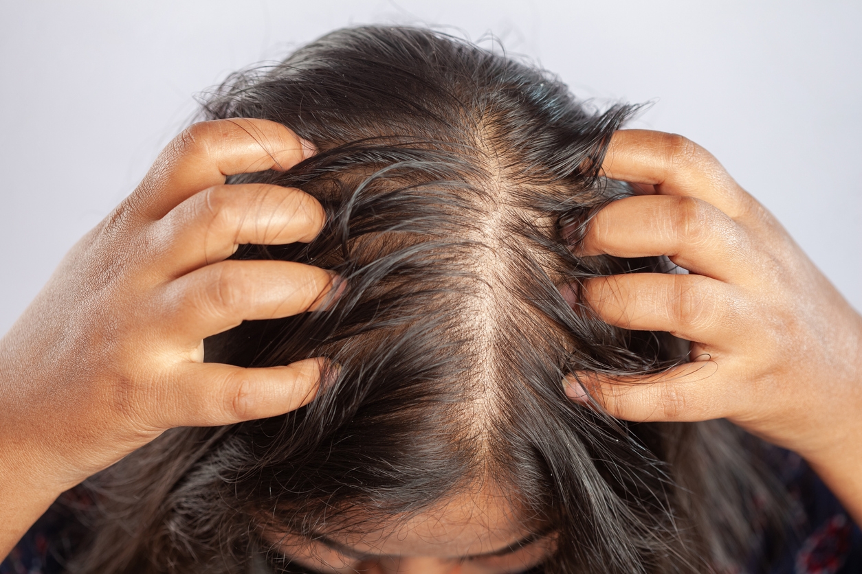 Rambut Mulai Botak? Ini 5 Penyebab yang Sering Terjadi